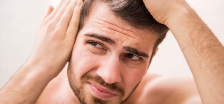 Overcome the problem of baldness