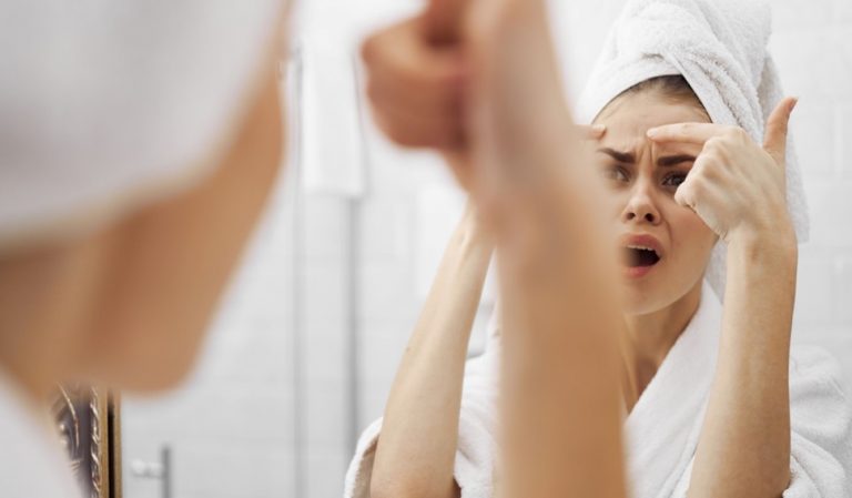 Best tactics you could try out if acne won’t clear