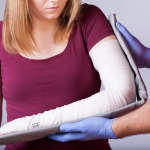 Comprehensive Guide to Treating Fractures in Tampa FL
