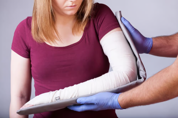 Comprehensive Guide to Treating Fractures in Tampa FL