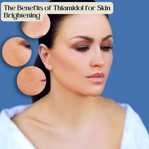 Thiamidol and Its Role in Reducing Hyperpigmentation